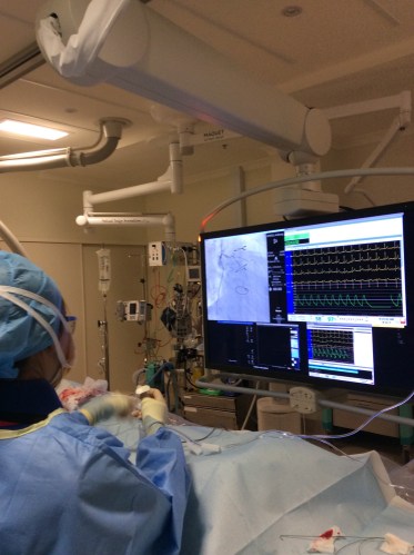 My heart monitors during the angiogram